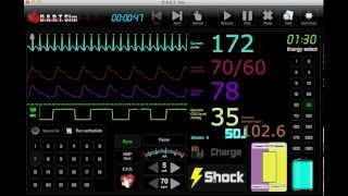 EKG Simulator  ECG Simulator [upl. by Ecerehs]