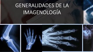 Generalidades de la Imagenología Rx US TAC y RM [upl. by Ynnatirb]