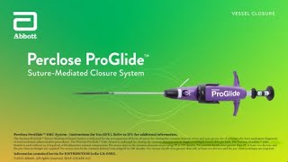 US Small Hole ProGlide™ Deployment Video [upl. by Finegan119]