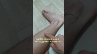 비골근 근막이완 Fibularis Longus Brevis SMR [upl. by Anidene872]