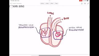 5 Cardiomyopathy [upl. by Aniraad699]