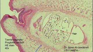 Taenia saginata proglottid cross section [upl. by Nbi]