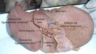 Ligaments of the liver  Opening structures of porta hepatis  Liver anatomy [upl. by Saberio]