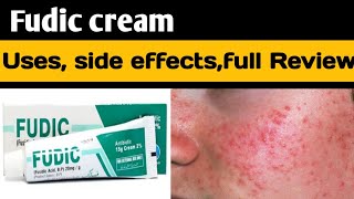 Fudic h cream use in urdu  Fudic h cream benefits  for acne skin [upl. by Vic]