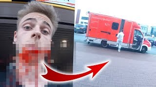 FAIL Unfall Krankenwagen muss kommen 😩 [upl. by Asoj]