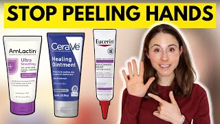 How to STOP SKIN PEELING ON THE HANDS amp FEET 🤔 Dermatologist DrDrayzday [upl. by Karl974]