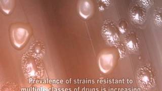 Streptococcus pneumoniae [upl. by Onairot741]