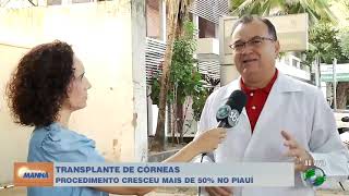 Transplante córneas cresceu mais de 50 no Piauí [upl. by Lipinski970]