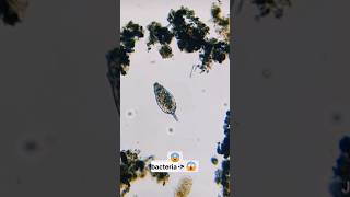 🤒Microscope view  बारिश का पानी shorts [upl. by Neomah52]