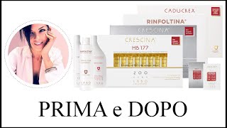 Crescina Prima e Dopo Recensioni  Labo Cosprophar Suisse [upl. by Eadahs94]