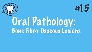 Oral Pathology  FibroOsseous Lesions  INBDE ADAT [upl. by Bodnar]