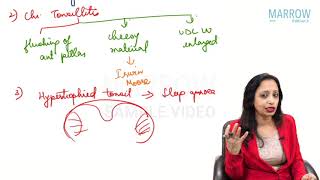 ENT  Tonsillectomy  Marrow Edition 5 Clinical Core Sample Video [upl. by Watkin]