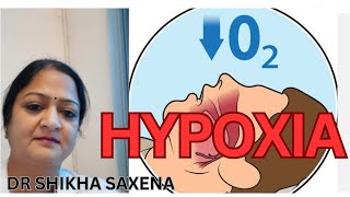 Hypoxic Classification of Hypoxia Telegram httpstmedrshikhasaxenahumanphysiology [upl. by Gearalt]