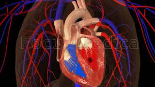 Atrial Fibrillation  Animated Atlas of Atrial Fibrillation [upl. by Cornia940]