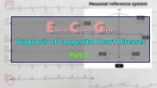 ECG Diagnosis of Congenital heart diseases PART 2 [upl. by Nitsua]