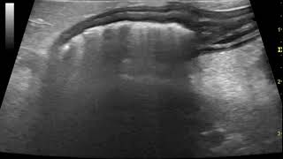 Ultrasonography of acute canine pancreatitis with associated colitis [upl. by Adran]