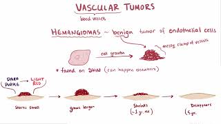 Glomus Tumor  Osmosis [upl. by Neimad812]