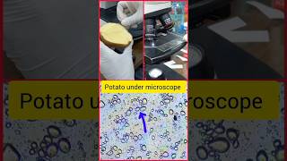 Solanum tuberosum under microscope potato shorts microscope bacteria [upl. by Jobina]