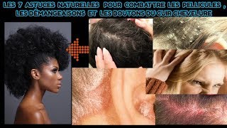 7 ASTUCES NATURELLES POUR COMBATTRE LES PELLICULES ET LES DEMANGEAISONS DU CUIR CHEVELURE [upl. by Llevaj]