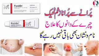 fucidin topical cream  fucidin cream  fucidin h cream uses in urdu  fucidin acid  how to use [upl. by Aihsaei559]