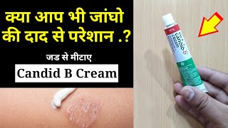 CANDIDB cream for itching  rashes and fungal infections uses and side effects full review [upl. by Shirlene3]