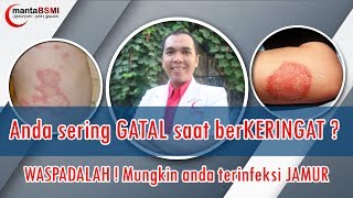 Gatal selangkangan  GATAL saat berKERINGAT  Kulit anda JAMURAN [upl. by Qerat421]