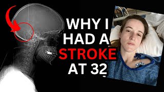 What having a stroke actually felt like [upl. by Nalaf]