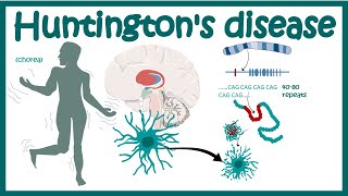 Huntingtons Disease  Pathology of Huntingtons Chorea  Diagnosis of Huntingtons disease [upl. by Puett]