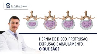 Hérnia de disco protusão extrusão e abaulamento discal O que são [upl. by Lea]