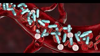 Septicaemia Blood poisoning [upl. by Navis300]