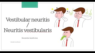 Vestibular neuritis  Neuritis vestibularis Essential medicine [upl. by Ellwood174]