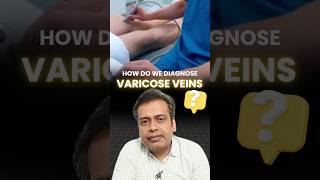 How do we diagnose VARICOSE VEINS  varicose veins examination  Varicose Veins Treatment Mumbai [upl. by Barrie451]