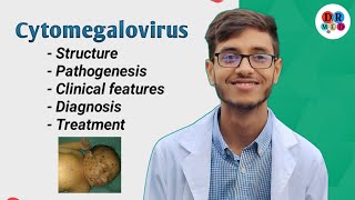 Cytomegalovirus  Herpes virus  Microbiology bangla lecture [upl. by Towers]