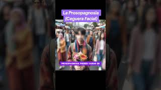 La prosopagnosia sabes que es y como se trata [upl. by Namzzaj]