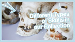 different types of real Human skulls [upl. by Altman]