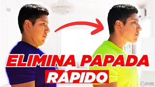 🔴 5 EJERCICIOS para ELIMINAR y REDUCIR la PAPADA en SOLO 3 MINUTOS😱 [upl. by Carlota]