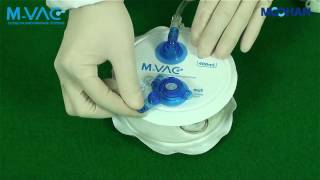 MVAC hemovac with both reliability and convenience [upl. by Aitan685]