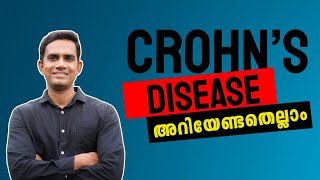 Crohn’s disease അറിയേണ്ടതെല്ലാം [upl. by Aicele]