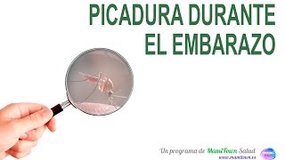 Picadura durante el embarazo [upl. by Asihtal]