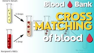 Blood Crossmatching🩸 The First Step in Blood Transfusions Education Point Blood Bank Processor [upl. by Chris]