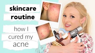 My full skin care routine amp how I CURED my acne [upl. by Beetner]