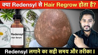 क्या Redensyl से Hair Regrow होता है Redensyl Serum for Hair Growth [upl. by Ashraf]