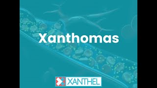 XANTHOMAS  How To Easily Remove Eyelid Xanthomas   Brought To You By XANTHEL® [upl. by Ive]