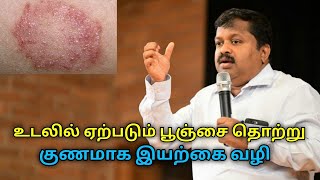 உடலில் ஏற்படும் பூஞ்சை தொற்று குணமாக இயற்கை வைத்தியம்DrSivaraman speech on fungal infection remedy [upl. by Sorcha]