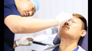 NonSurgical Nose Job Liquid Rhinoplasty  Seoul Guide Medical [upl. by Nangem]