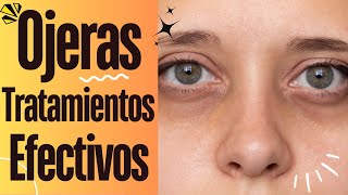 Ojeras Oscuras Como Quitarlas [upl. by Tiebold]