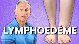 10 exercices pour le gonflement du lymphœdème des jambes ou lœdème des membres inférieurs [upl. by Byrle144]