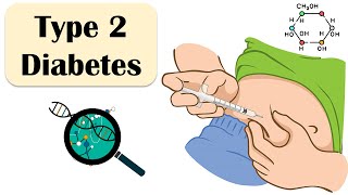 Type 2 Diabetes  Causes Risk Factors Signs amp Symptoms Treatment  Everything You Need To Know [upl. by Wistrup822]