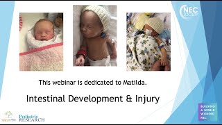 Intestinal Development and Injury Webinar Recording [upl. by Caundra]