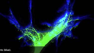 Nerve growth conessubtitles only [upl. by Norab]